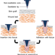 Image for article titled Doctors keep skin grafts in place using parasitic worms
